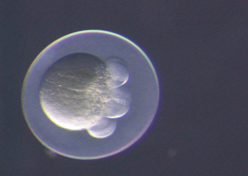  Befruchtetes Fischei mit mehr als zwei Zellen. (Bild: Stefan Scholz / Helmholtz-Zentrum für Umweltforschung GmbH - UFZ)